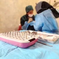جراحی ایمپلنت و روکش ( فیکسچر کره ای)|خدمات آرایشگری و زیبایی|رشت, گلسار|دیوار