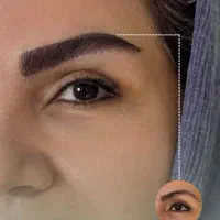 جشنواره ویژه میکرو کاشت