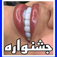 کامپوزیت دندان/دندانپزشکی/عصبکشی/ترمیم/پالیش