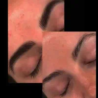 مدل میکروبلیدینگ فیبروز کاورتاتوقدیمی نانوبروز|خدمات آرایشگری و زیبایی|ری, اقدسیه|دیوار