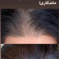 بهترین خدمات با بهترین متریال از ما بخواهید|خدمات آرایشگری و زیبایی|شاهرود, |دیوار