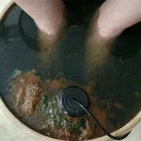 طب سوزنی و امبدنیگ و کاشت نخ