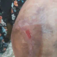 تزریقات وپانسمان در منزل|خدمات آرایشگری و زیبایی|نجفآباد, قدس|دیوار