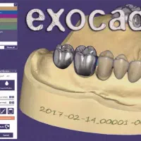 طراحی اگزودکد