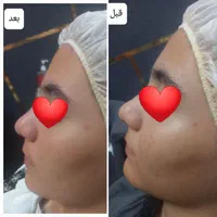فشیال و خدمات جوانسازی ارغوان بر پایه علم نوین|خدمات آرایشگری و زیبایی|نیشابور, محله میدان باغات|دیوار