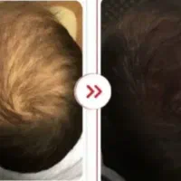 قبل از اینکه دیر بشه