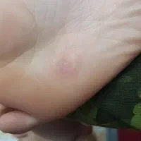 درمان معجزه گر|آرایشی، بهداشتی، درمانی|شاهینشهر, فردوسی|دیوار