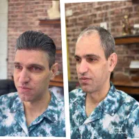 خدمات نصب پروتز مو و تعویض چسب