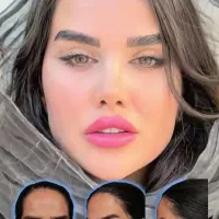 تزریق تخصصی ژل و بوتاکس