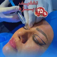 جشنواره بلفاروپلاستی(ویژه شب یلدا)