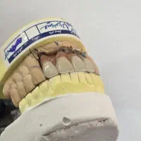 لابراتور