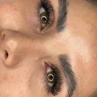 کاشت مژه هیدن