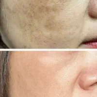 کرم معجزه اصل و وسایل کرم معجزه