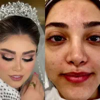 انجام خدمات زیبایی در منزل شما