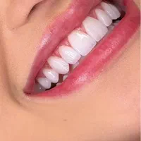 جشنواره خدمات دندانپزشکی(کامپوزیت،لمینت،عصبکشی،