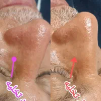 تزریق هرنوع خدمات زیبایی به صورت تضمینی|خدمات آرایشگری و زیبایی|کارون, |دیوار