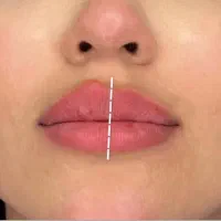 مدل برای تزریق ژل لب هر سی سی ۶۷۰ فقط