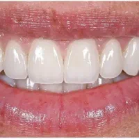 استخدام دستیار دندانپزشک
