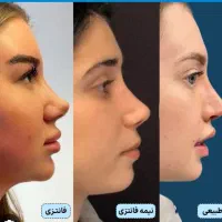 عمل زیبایی|خدمات آرایشگری و زیبایی|تهران, زعفرانیه|دیوار