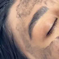 جشنواره لیزر تتو و کربن لیزر