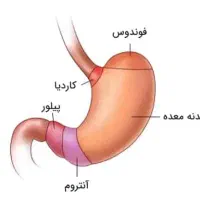 رفلاکس معده