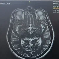 ثبت نسخه توسط پزشک متخصص