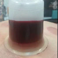 خدمات حجامت و بادکش درمانی