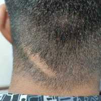 آموزش متد پر درآمد میکرو اسکالپ با تخفیف طلایی