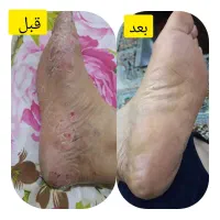 درمان از دل طبیعت