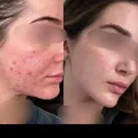 کرم عروس دریایی