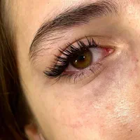 کاشت مژه هیدن و گربه ای