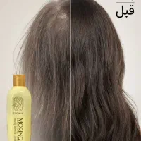 شامپو مورینگا|آرایشی، بهداشتی، درمانی|تهران, یافت آباد جنوبی|دیوار