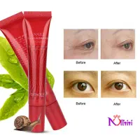 کرم دور چشم لانبنا|آرایشی، بهداشتی، درمانی|درگز, |دیوار