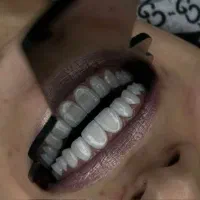 بیماریاب دندانپزشکی(قلهک)