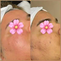 فشیال تخصصی فقط ۶۰۰ ت در حکیمیه /شرق تهران