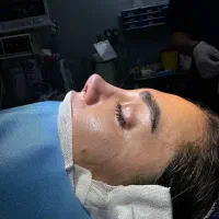 لیپوماتیک ابدومینوپلاستی پروتزماموبینی