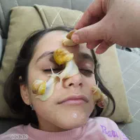 حلزون کلاژن ساز|آرایشی، بهداشتی، درمانی|مشکیندشت, |دیوار