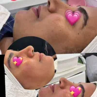 کاشت مژه هیدن لیفت ابرو رنگ مو وکراتین فشیال|خدمات آرایشگری و زیبایی|بندرعباس, |دیوار