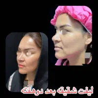 جشنواره بلفارو پلاستی پلک فقط 8500|خدمات آرایشگری و زیبایی|اصفهان, بهار آزادی|دیوار