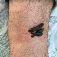 حجامت،پرسینگ،ماساژ سنگ داغ،زالو درمانی