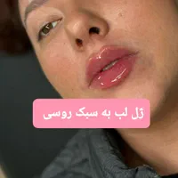 ژل لب زاویه چانه گونه  مزوبوتاکس هایفو لیزرمو زائد|خدمات آرایشگری و زیبایی|مشهد, فرهنگ|دیوار