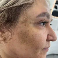 درمان قطعیی وکلینیکی