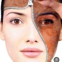 جراحی زیبایی زنان ،فارغ التحصیل از دانشگاه ایتالیا