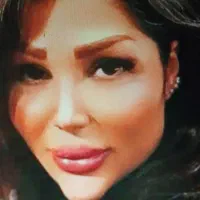 ژل وبوتاکس