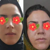 از لک و خشکی و چروک پوست خسته شدی