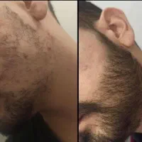 کاشت ممنوع