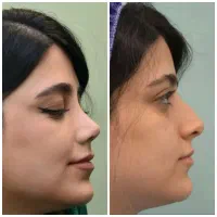 عمل بینی جشنواره نوروزی با قیمت سال ۴۰۴