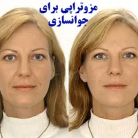 کلینیک تخصصی زیبایی نسیم شعبه غرب|خدمات آرایشگری و زیبایی|تهران, شاهین|دیوار
