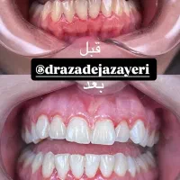 تخفیف خدمات دندانپزشکی|خدمات آرایشگری و زیبایی|رشت, گلسار|دیوار