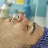 عمل زیبای بینی|خدمات آرایشگری و زیبایی|قائم‌شهر, |دیوار